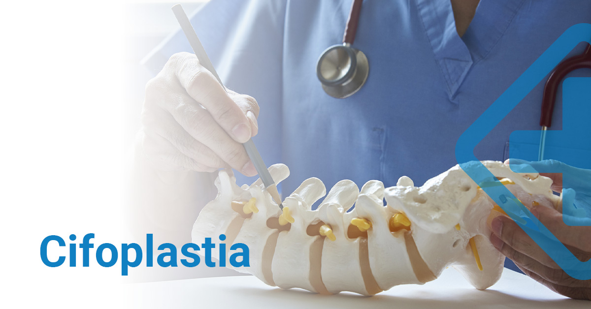 Cifoplastia